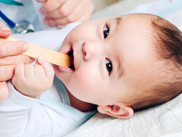 Nấm miệng ở trẻ sơ sinh - Dấu hiệu nhận biết và cách xử lý