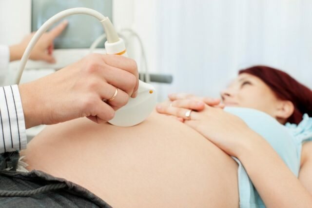 Xét nghiệm dị tật thai nhi ở tuần thứ mấy thì chính xác?