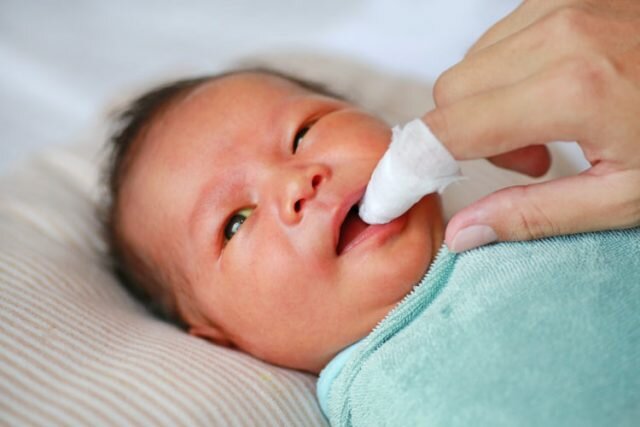 Nấm miệng ở trẻ sơ sinh - Dấu hiệu nhận biết và cách xử lý